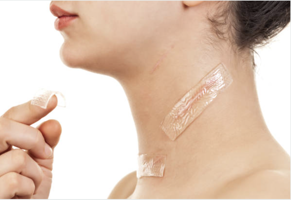 A woman applies clear silicone scar tape to multiple healed scars on her neck, demonstrating practical use for raised or post-surgical scars.